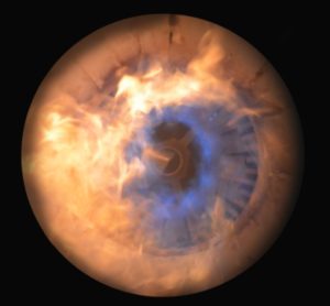 Exo-eclipse in X-ray Vision